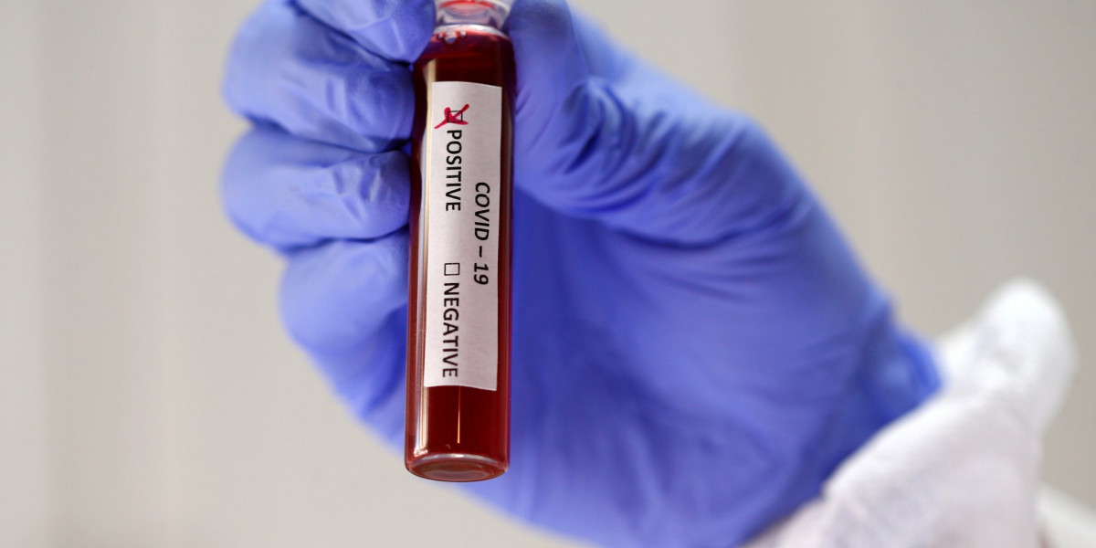 В Кузбассе четвертая лаборатория начала проводить тесты на коронавирус