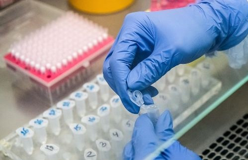 Главный пульмонолог Минздрава РФ: "До 40% тестов на коронавирус могут давать ложноотрицательный результат"
