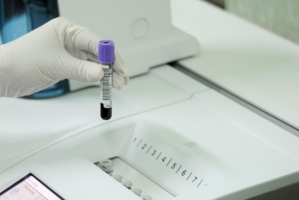 В Кузбассе срок действия ПЦР-тестов на коронавирус сокращен с 72 до 48 часов