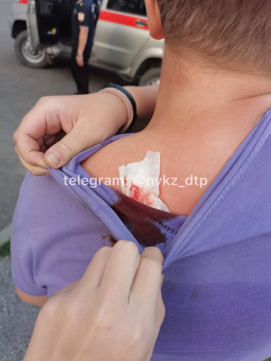 В Кузбассе неизвестный ранил подростка из пневматического оружия
