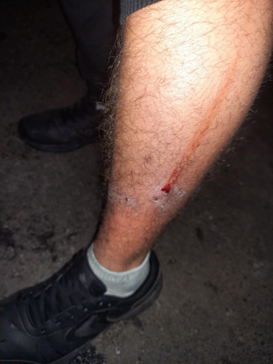 В Прокопьевске собака напала на мужчину