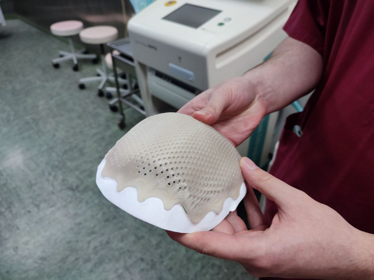 В Кузбассе врачи восстановили череп участнику СВО с минно-взрывным ранением