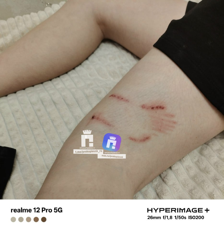 Бездомная собака напала на подростка: СУ СК завёл дело о халатности