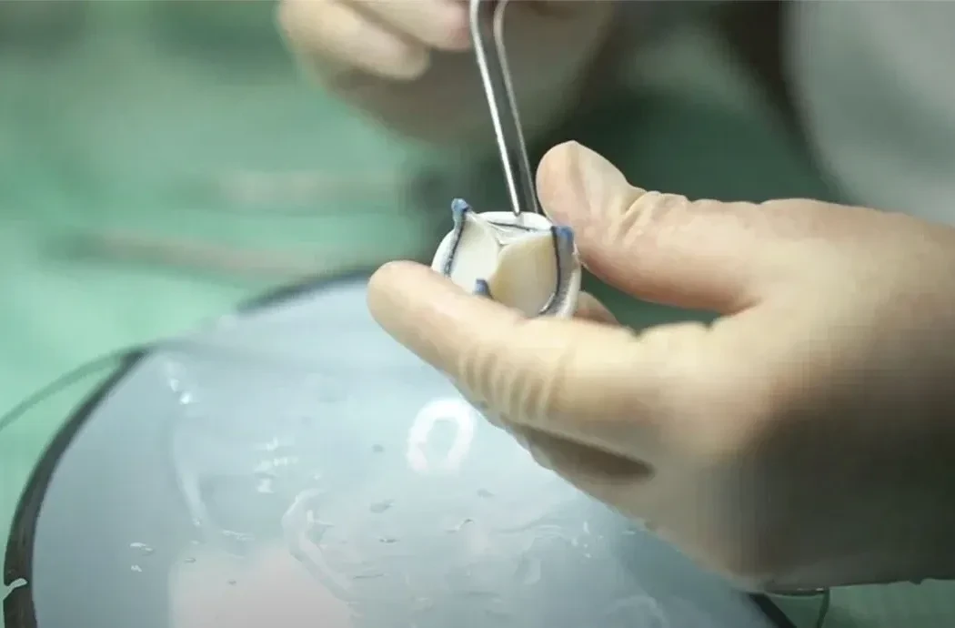 В Кузбассе запустили производство биопротезов клапанов сердца